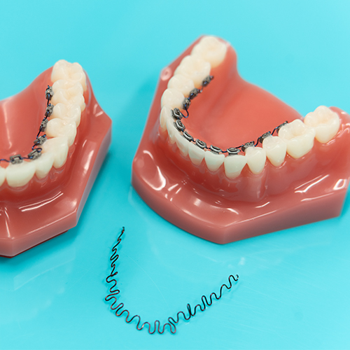 pollack ortho inbrace edit